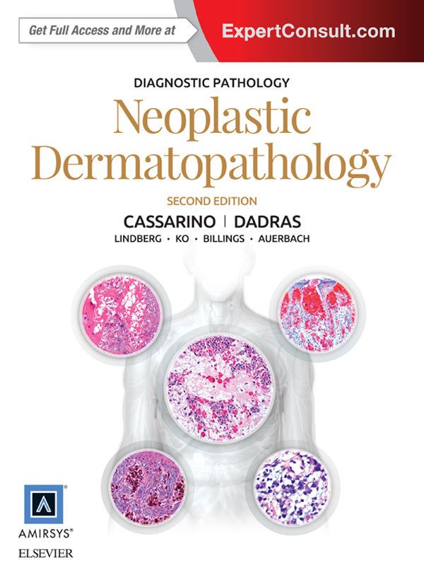 Diagnostic Pathology Neoplastic Dermatopathology David S Cassarino
