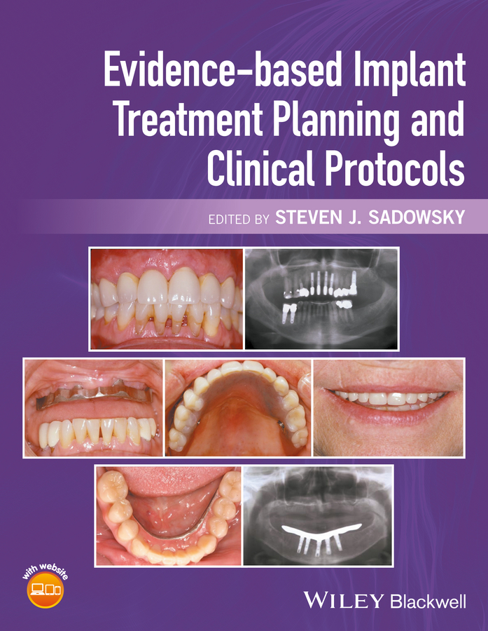 Evidencebased Implant Treatment Planning And Clinical Protocols Steven J Sadowsky