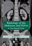 Radiology Of The Abdomen And Pelvis A Casebased Guide Sep 30 20241032588780crc Presspdf Swati Goyal