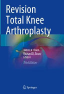 Revision Total Knee Arthroplasty Third Edition 3rd James V Bono