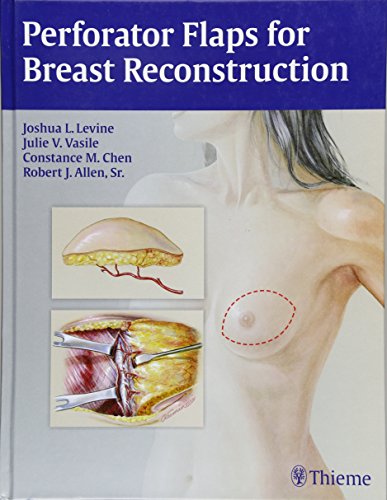 Perforator Flaps For Breast Reconstruction 1st Edition Joshua L Levine
