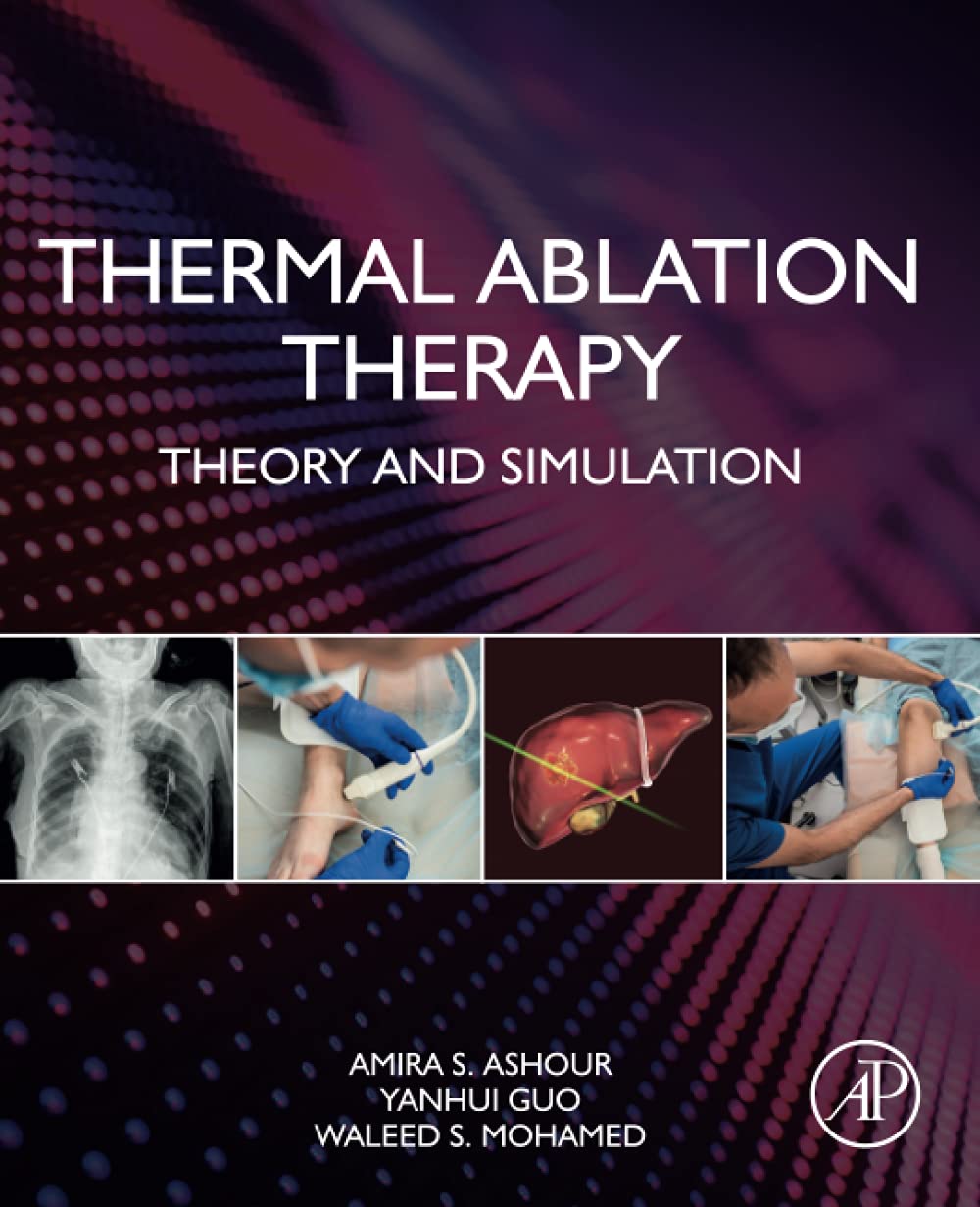 Thermal Ablation Therapy 1st Edition Amira S Ashour Yanhui Guo