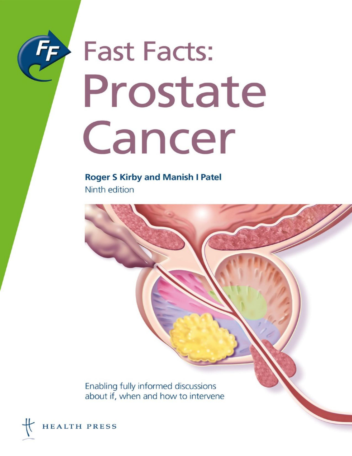 Fast Facts Prostate Cancer Professor Roger S Kirby Dr Manish I Patel