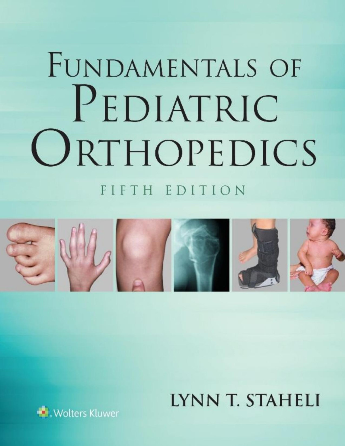 Fundamentals Of Pediatric Orthopedics Staheli Lynn T