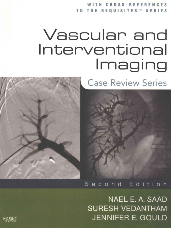 Vascular And Interventional Imaging Case Review Series Second Editionnael Ea Saadmbbch Suresh Vedantham 2010th Edition Md Jennifer Egould