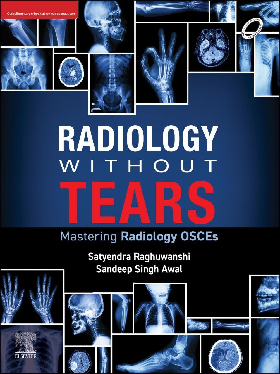 Radiology Without Tears Mastering Radiology Osces Satyendra Raghuwanshi Author