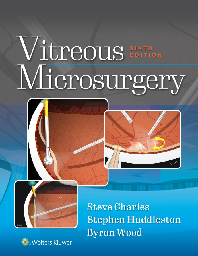 Vitreous Microsurgery Steve Charlesstephen Huddlestonbyron Wood Stephen Huddleston