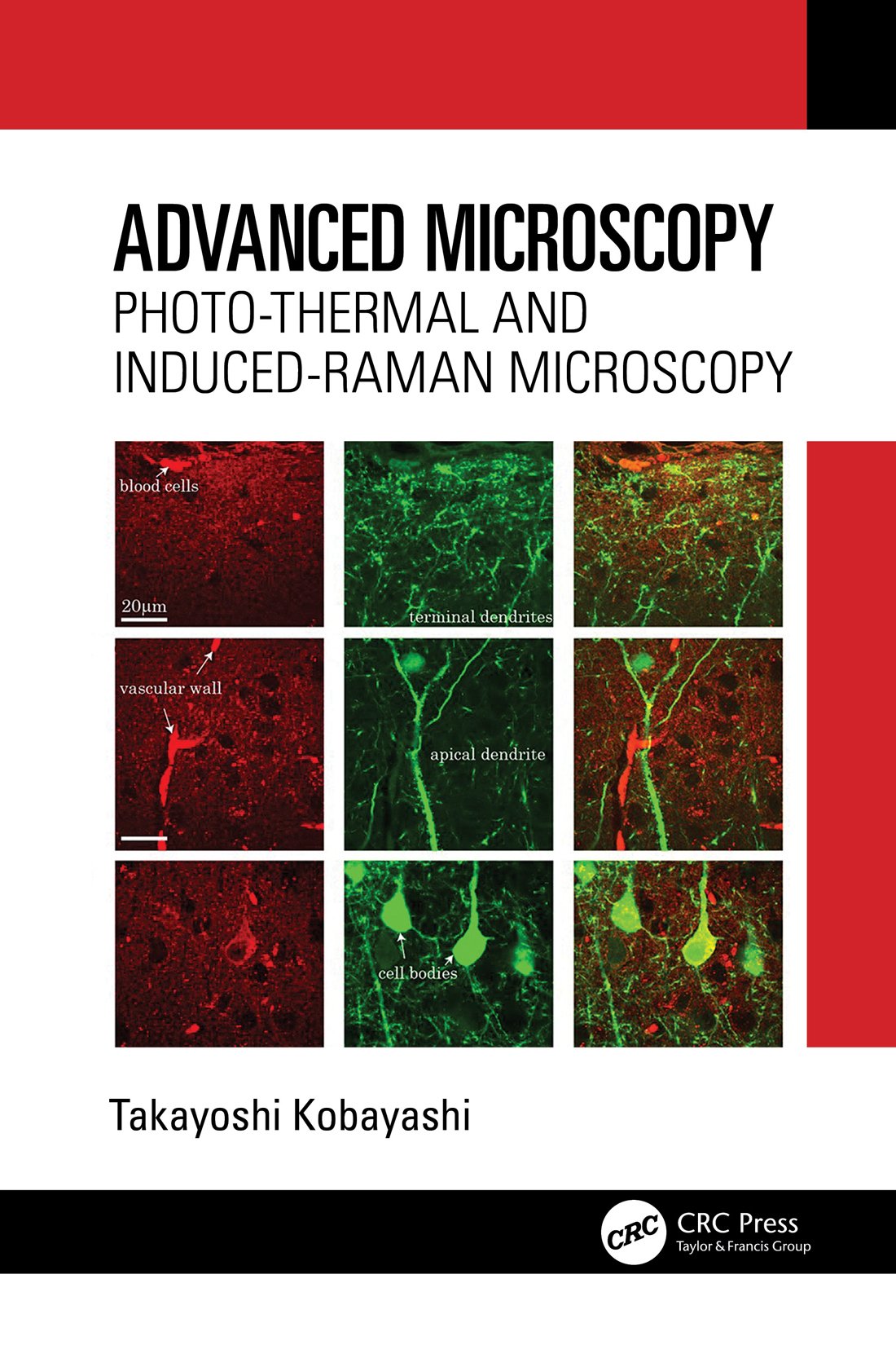 Advanced Microscopy Photothermal And Inducedraman Microscopy Takayoshi Kobayashi