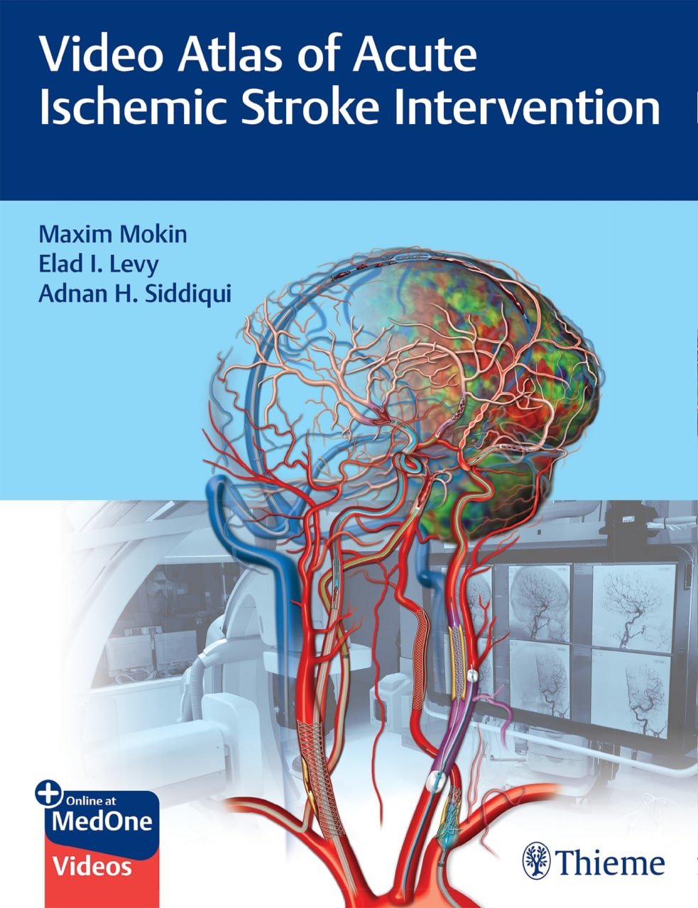 Video Atlas Of Acute Ischemic Stroke Intervention 1st Edition Maxim Mokin