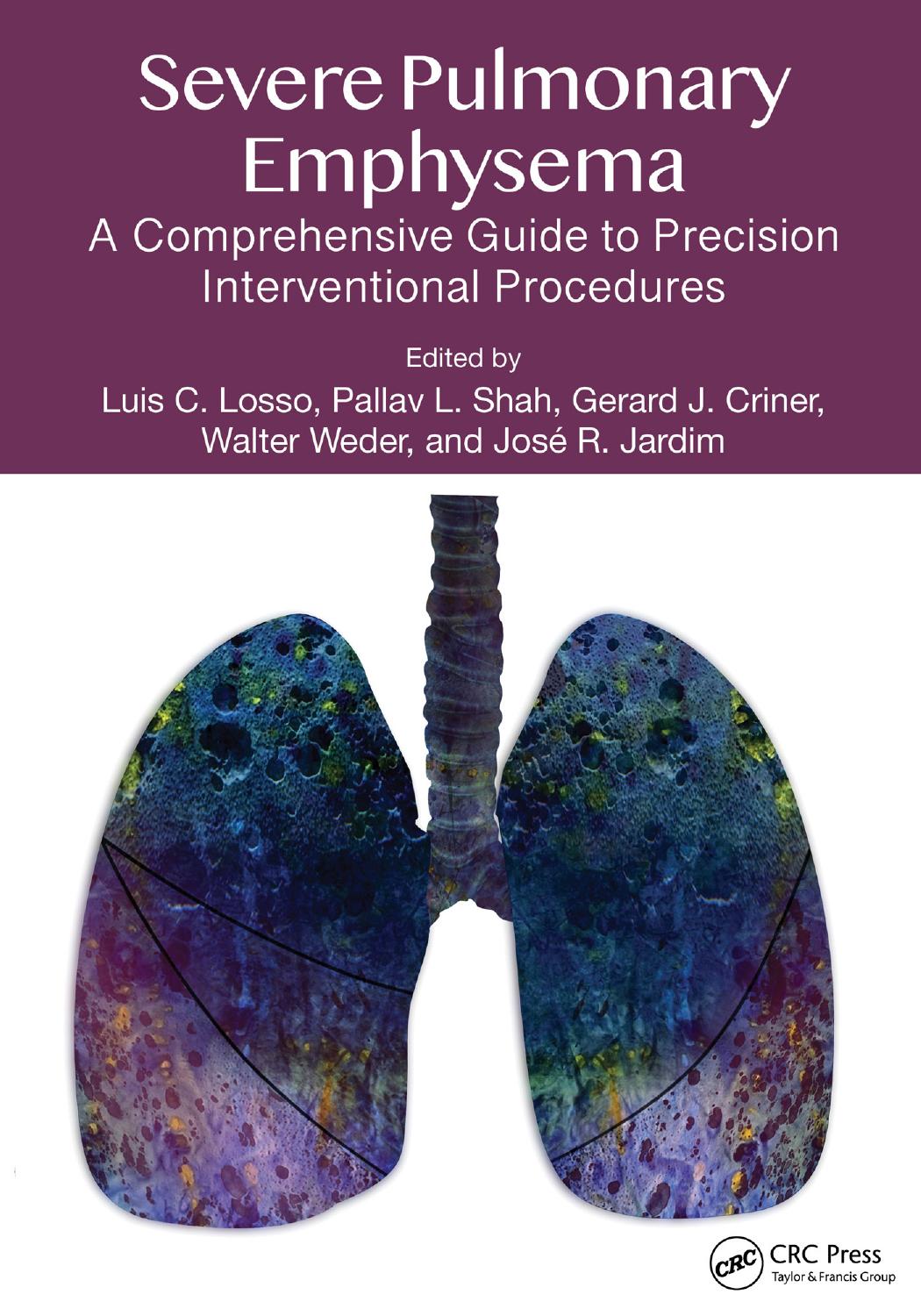 Severe Pulmonary Emphysema A Comprehensive Guide To Precision Interventional Procedures Edited By Luis C Losso Pallav L Shah Gerard J Criner Walter Weder And Jos R Jardim