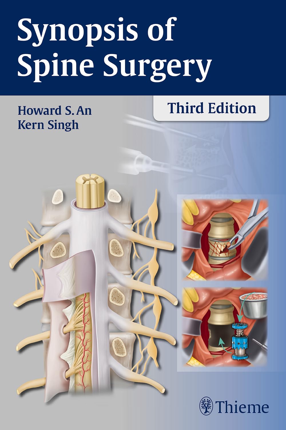Synopsis Of Spine Surgery 3rd Howard S An Kern Singh