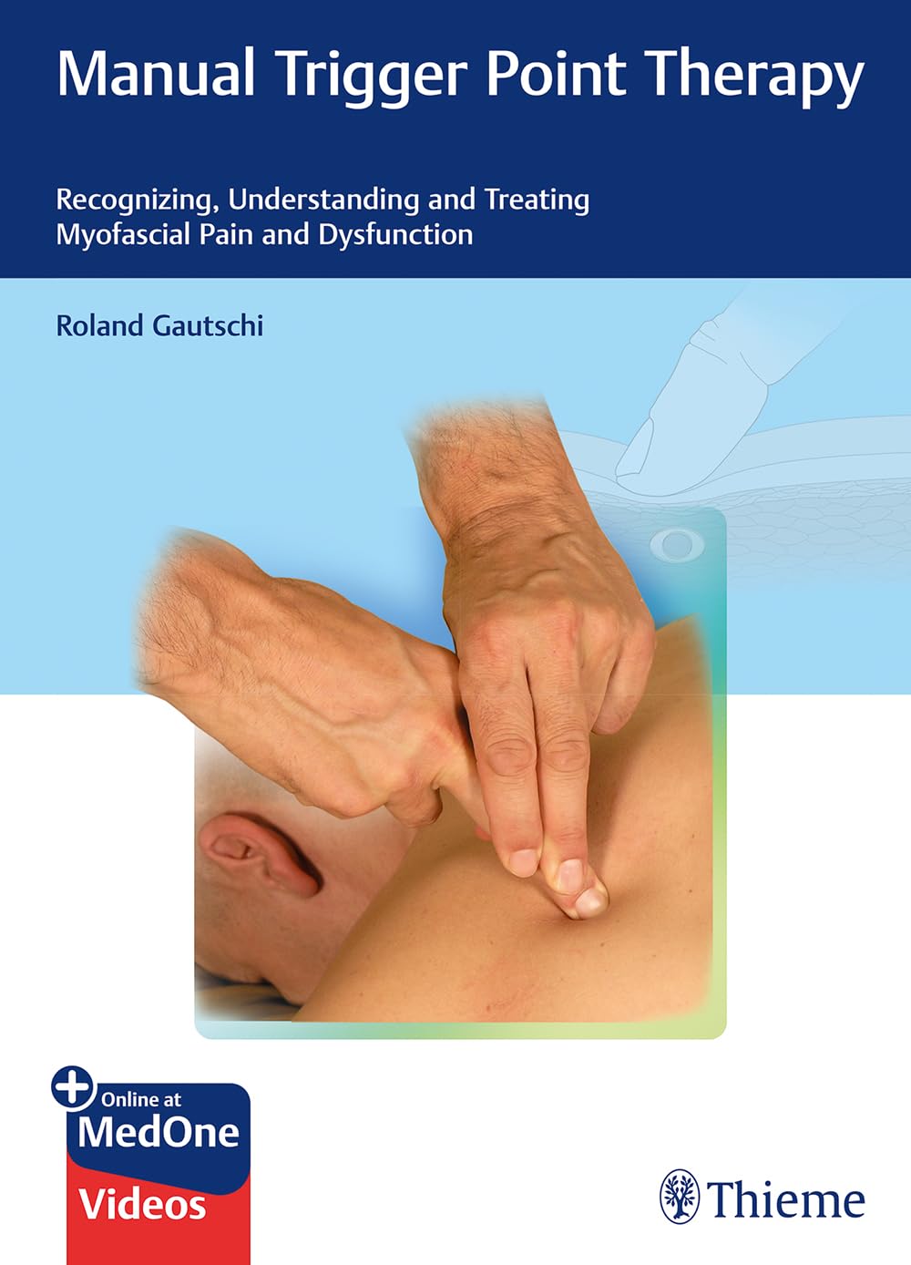 Manual Trigger Point Therapy Recognizing Understanding And Treating Myofascial Pain And Dysfunction 1st Edition Roland Gautschi