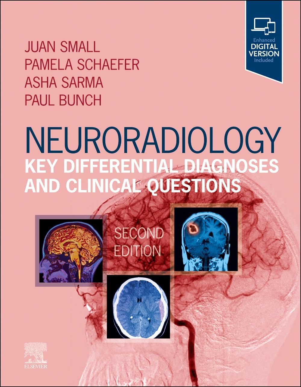 Neuroradiology Key Differential Diagnoses And Clinical Questions 2nd Juan E Small