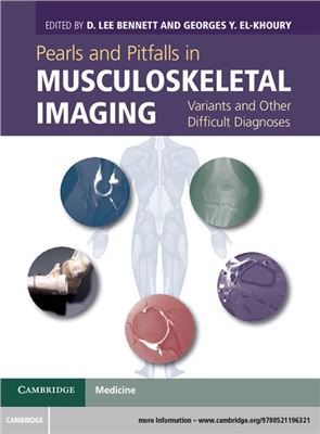 Pearls And Pitfalls In Musculoskeletal Imaging Variants And Other Difficult Diagnoses New D Lee Bennett Editor