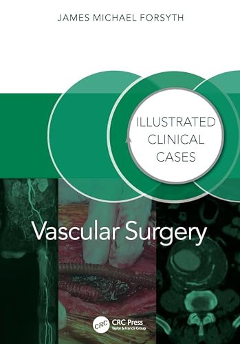 Vascular Surgery 1st Edition James Forsyth
