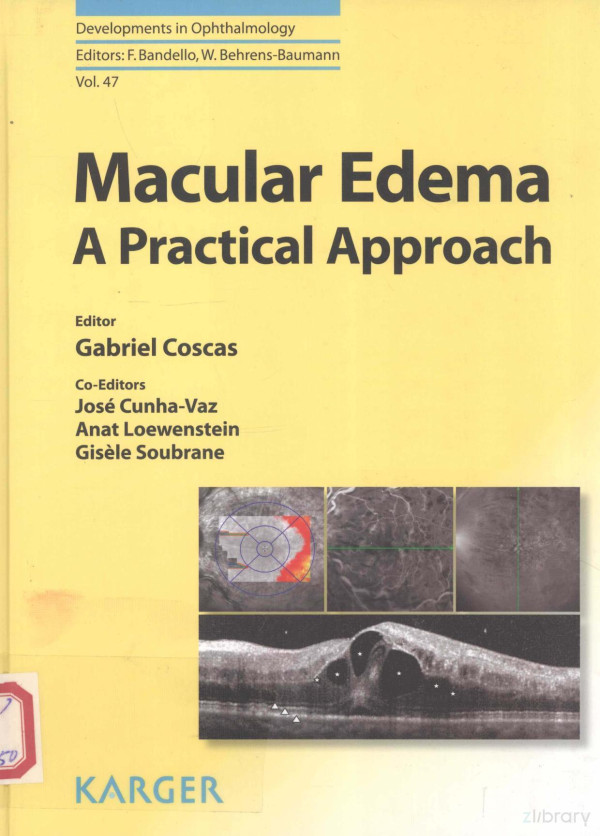 Macular Edema A Practical Approach 2010th Edition Gabriel Coscas