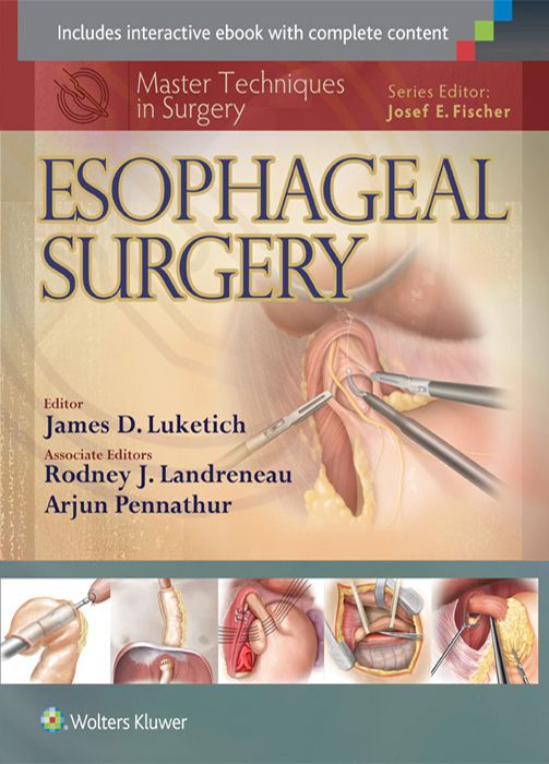 Master Techniques In Surgery Esophageal Surgery Luketich James D