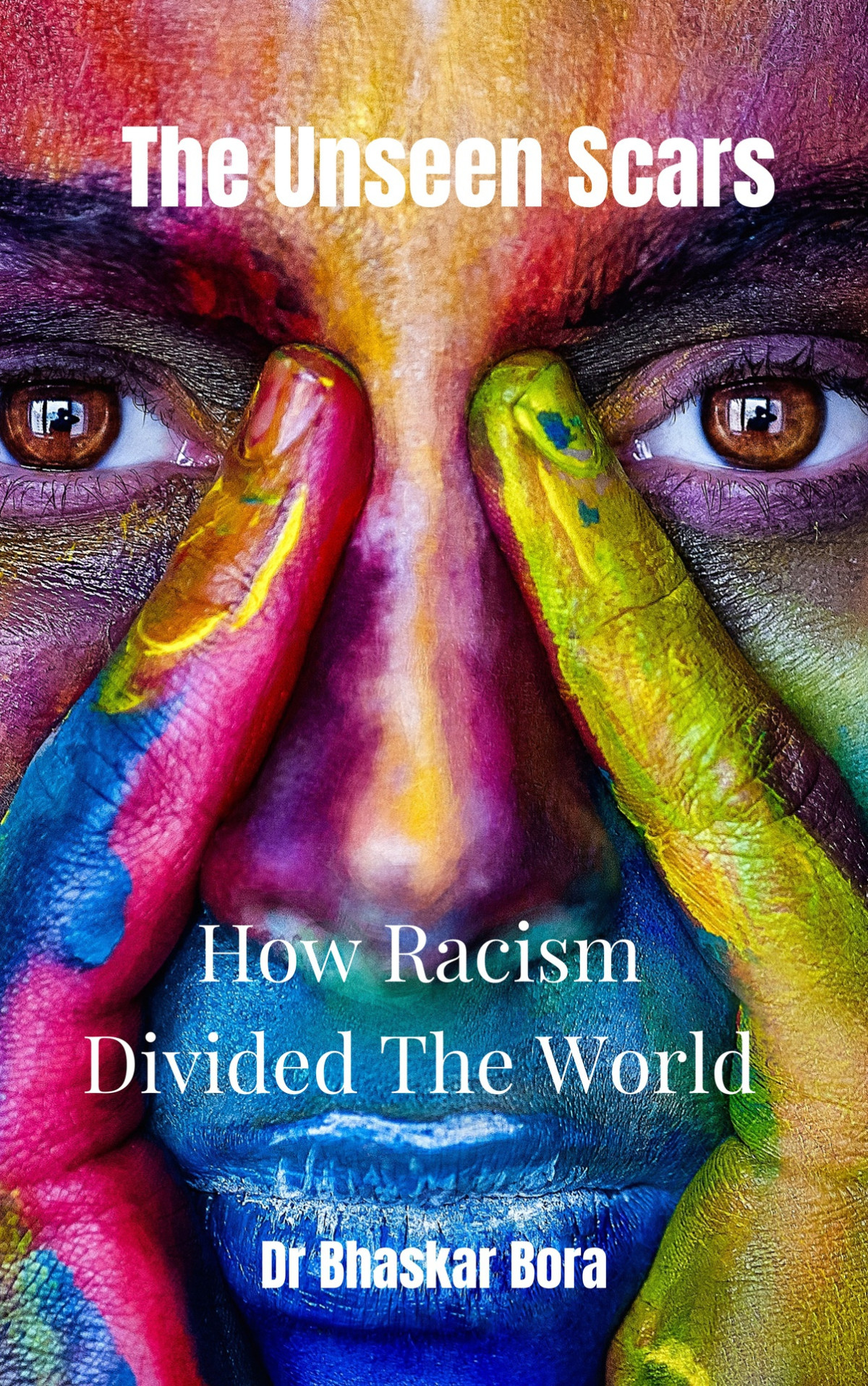 The Unseen Scars How Racism Divided The World Bora Dr Bhaskar