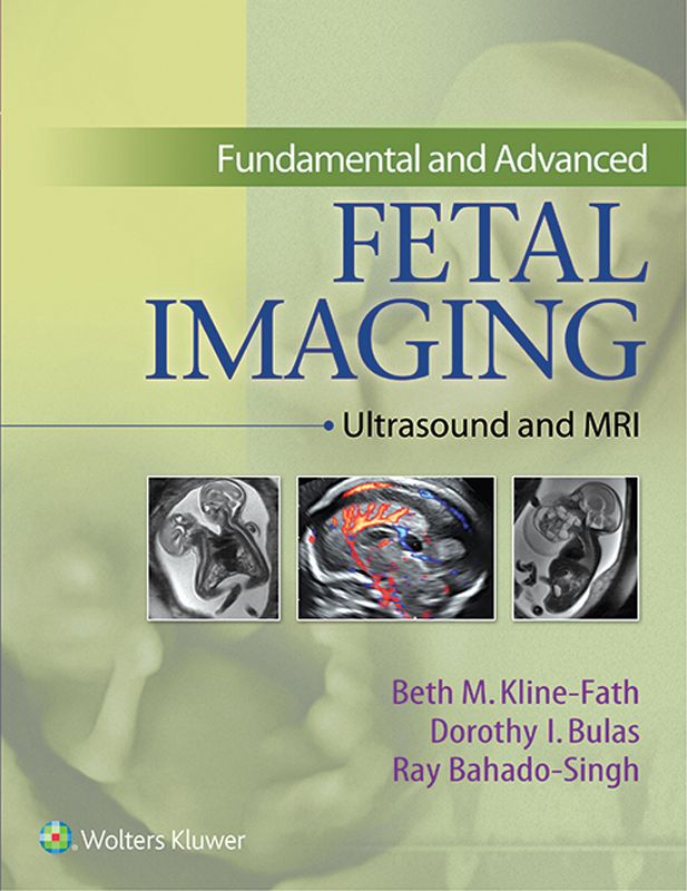 Fundamental And Advanced Fetal Imaging Ultrasound And Mri Klinefath