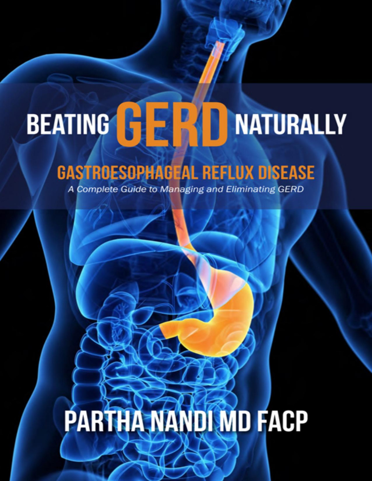 Beating Gerd Naturally A Complete Guide To Managing And Eliminating Gerd 1st Edition Partha Nandi Md