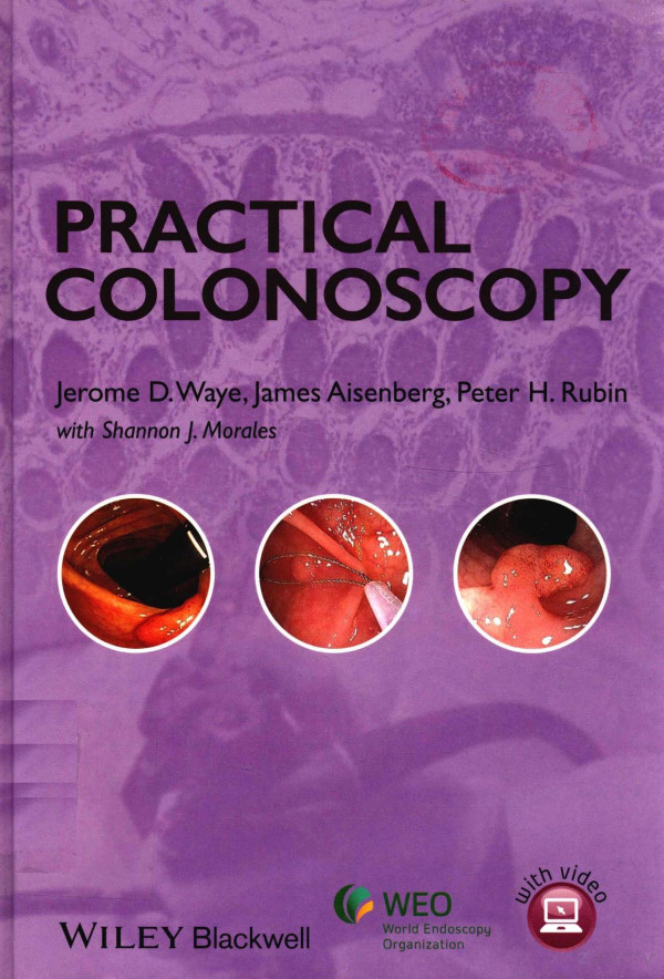 Practical Cilonoscopy 2013th Edition Jerome Dwaye