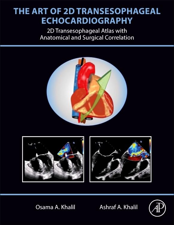 The Art Of 2d Transesophageal Echocardiography 2d Transesophageal Atlas With Anatomical And Surgical Correlation Feb 19 20240443187983academic Presspdf 1st Edition Osama A Khalil