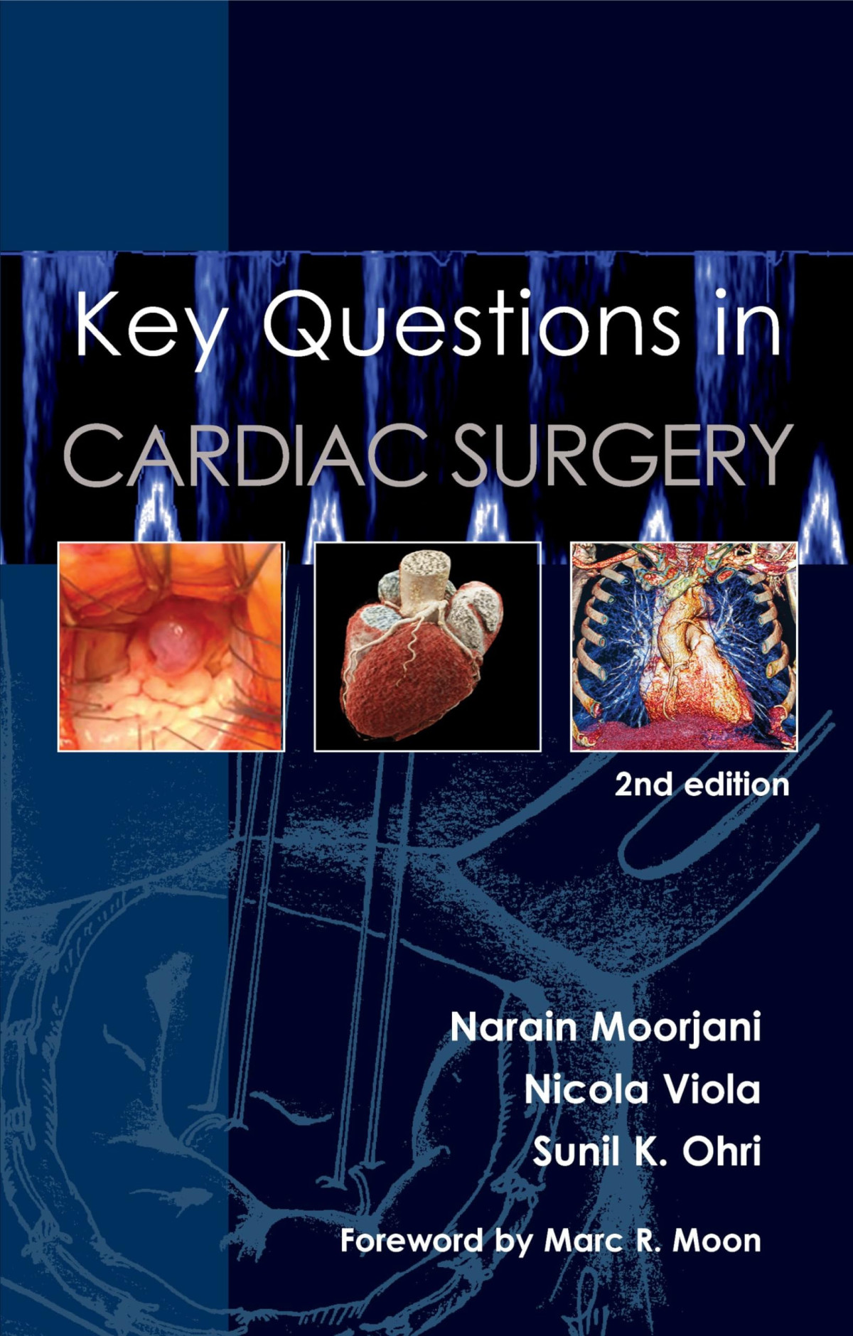 Key Questions In Cardiac Surgery 2nd Edition Narain Moorjani