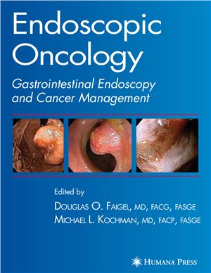 Endoscopic Oncology Gastrointestinal Endoscopy And Cancer Management Faigel Duglas O