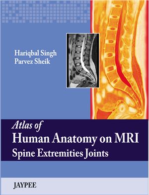 Atlas Of Human Anatomy On Mri Spine Extremities Joints Singh H