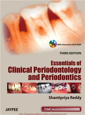 Essentials Of Clinical Periodontology And Periodontics 3rd Reddy Shantipriya