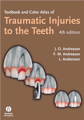 Textbook And Color Atlas Of Traumatic Injuries To The Teeth 4th Edition Andreasen J