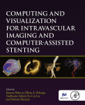 Computing And Visualization For Intravascular Imaging And Computerassisted Stenting 1st Edition Simone Balocco