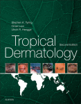 Tropical Dermatology 2nd Edition Steven K Tyring Omar Lupi And Ulrich R Hengge Auth