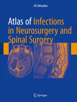 Atlas Of Infections In Neurosurgery And Spinal Surgery Ali Akhaddar Auth