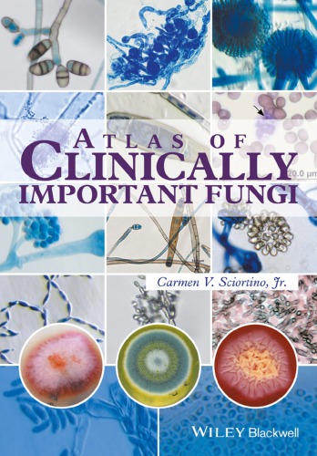 Atlas Of Clinically Important Fungi Sciortino Carmen V