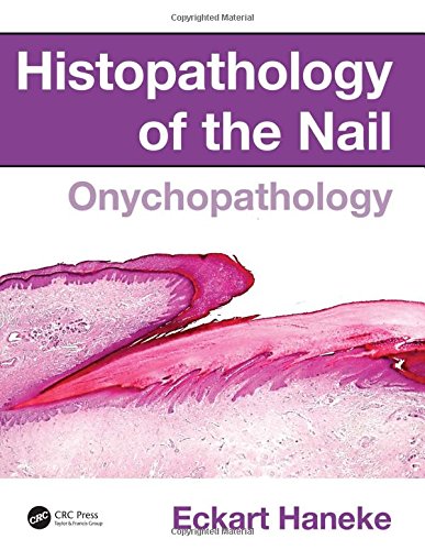 Histopathology Of The Nail Onychopathology 1st Edition Eckart Haneke