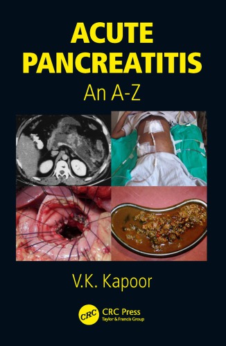 Acute Pancreatitis An Az Vinay Kumar Kapoor