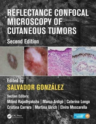 Reflectance Confocal Microscopy Of Cutaneous Tumors Second Edition Second Edition Salvador Gonzalez