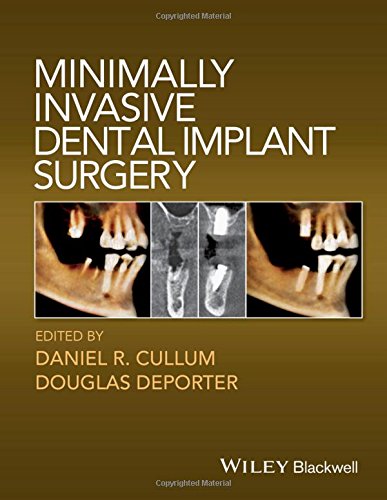 Minimally Invasive Dental Implant Surgery 1st Edition Daniel R Cullum