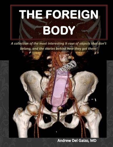 The Foreign Body A Collection Of The Most Interesting Xrays Of Things That Dont Belong And The Stories Behind How They Got There Andrew Del Gaizo Md