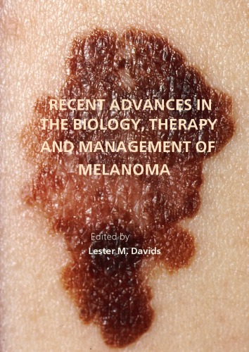 Recent Advances In The Biology Therapy And Management Of Melanoma Davids