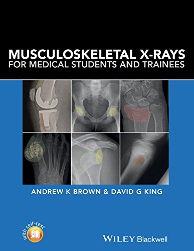 Musculoskeletal Xrays For Medical Students And Trainees 1st Edition Andrew K Brown