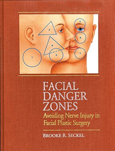 Facial Danger Zones Avoiding Nerve Injury In Facial Plastic Surgery 2nd Edition Brooke Seckel