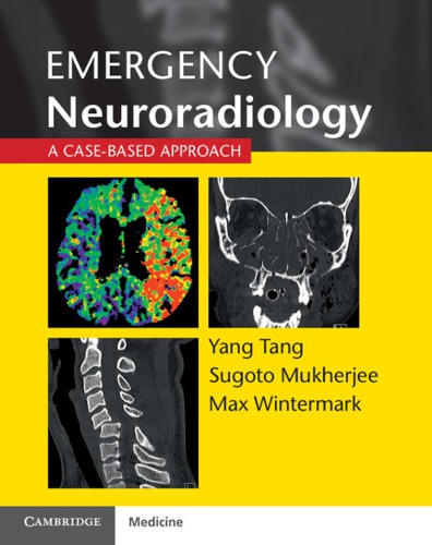 Emergency Neuroradiology A Casebased Approach 1st Edition Yang Tang
