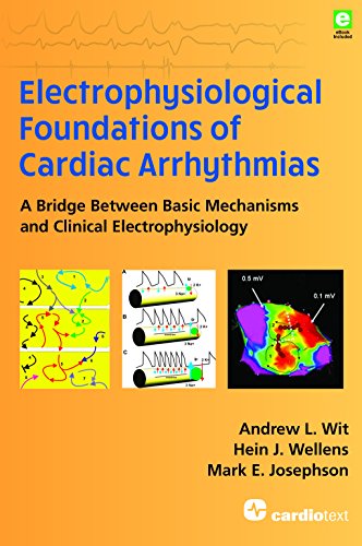 Electrophysiological Foundations Of Cardiac Arrhythmias A Bridge Between Basic Mechanisms And Clinical Electrophysiology Andrew L Wit
