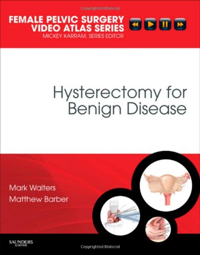 Hysterectomy For Benign Disease Mark D Walters Matthew Barber