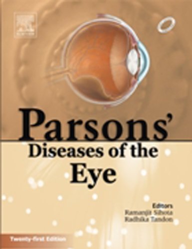 Parsons Diseases Of The Eye Radhika Tandon