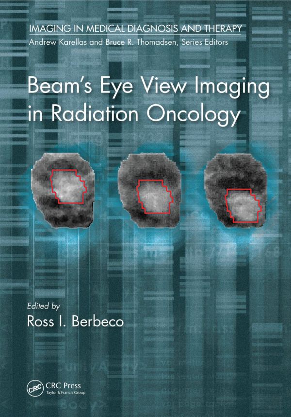 Beams Eye View Imaging In Radiation Oncology 1st Edition Ross I Berbeco Phd