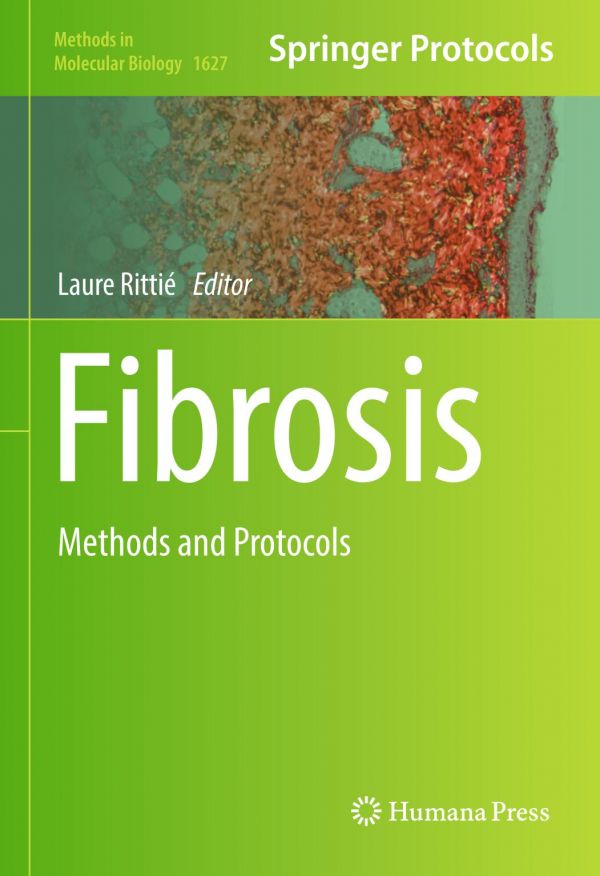 Fibrosis Methods And Protocols Rittie Laure