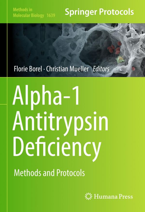 Alpha1antitrypsin Deficiency Methods And Protocols Borel